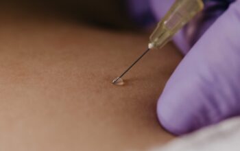 Latest Cosmetic Surgeries Of 2021