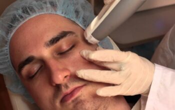 How To Get Ready For A Microdermabrasion – 8 Things To Do